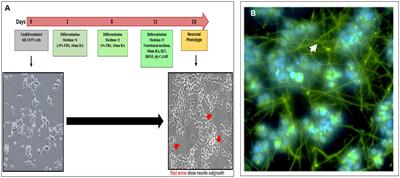 TSH enhances neurite outgrowth